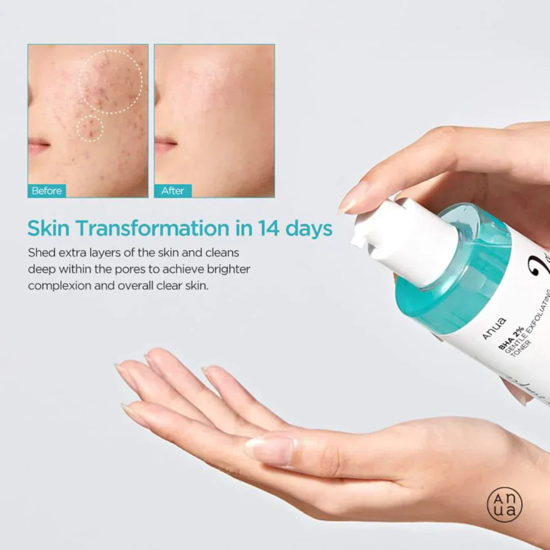 Anua BHA 2% švelnus eksfolijuojantis tonikas 150 ml
