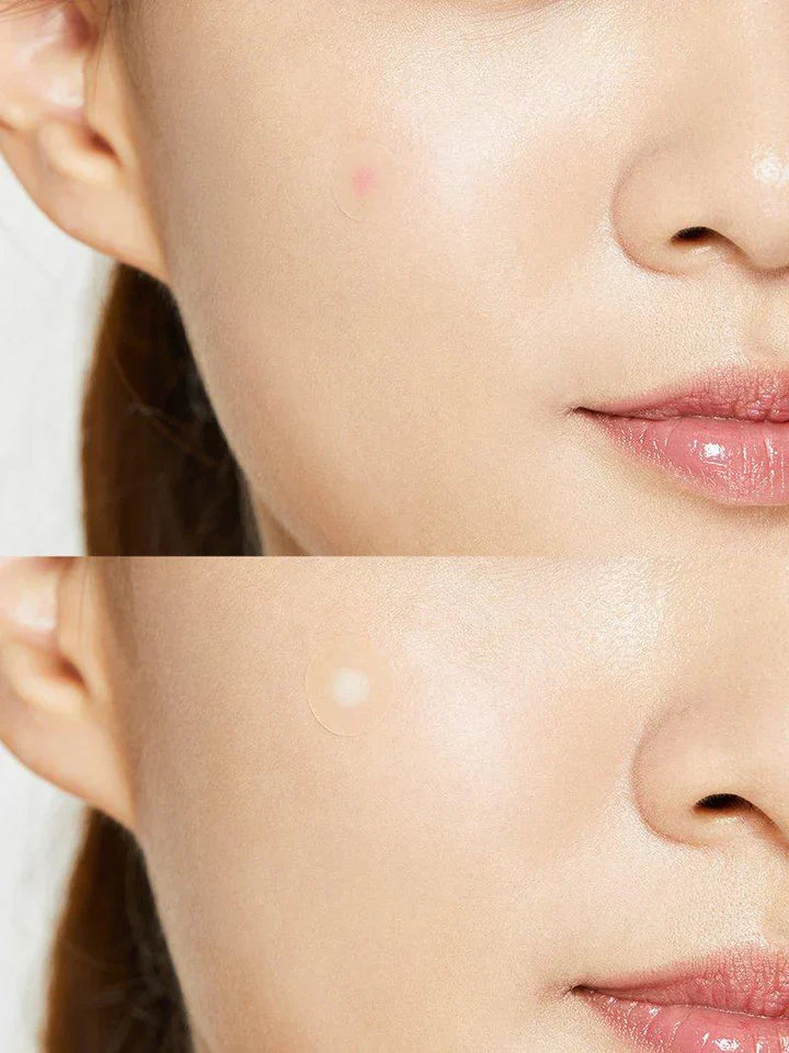 COSRX spuogų pleistrai „Acne Pimple Master Patch“ 24 vnt.