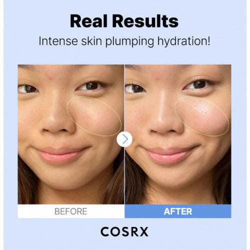 COSRX The Hyaluronic Acid 3 serumas 20 ml