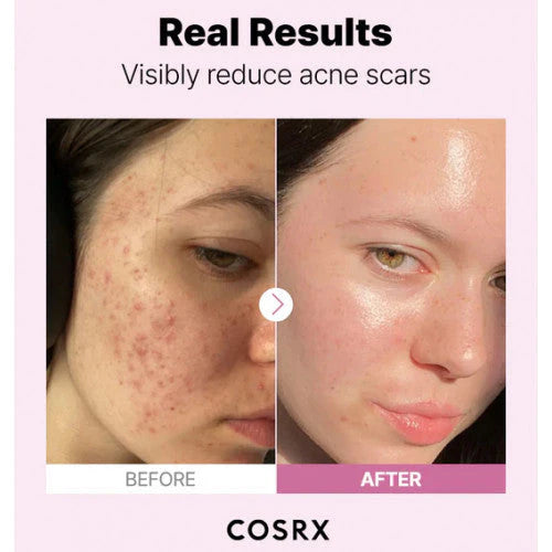 COSRX The Niacinamide 15 serumas